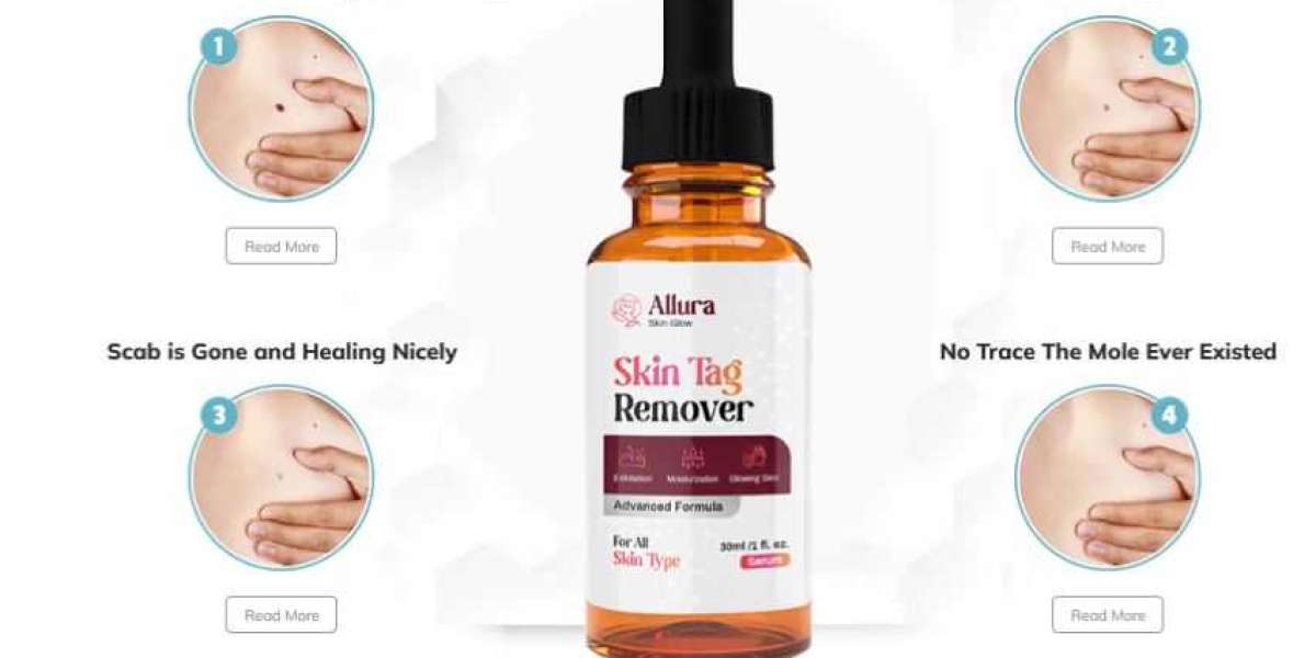 Here to Buy Allura Skin Glow Skin Tag Remover For a Special Discounted Price Today