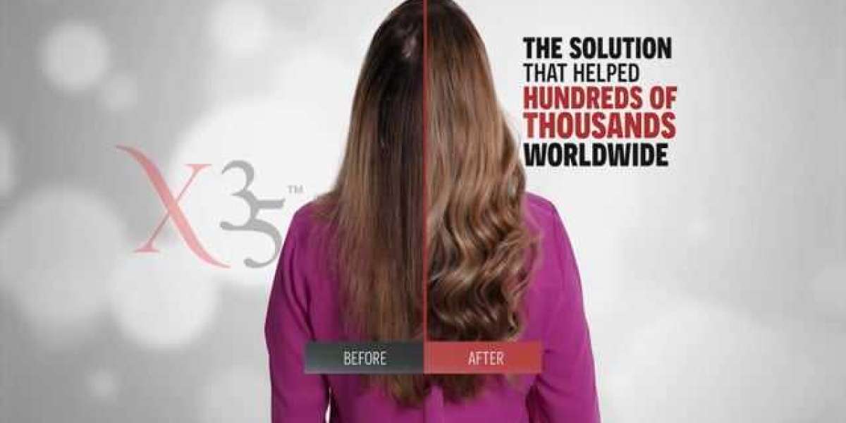 HAIR XCELLERATION PROGRAM's Hair Loss Serum Can Change Your Hair Game