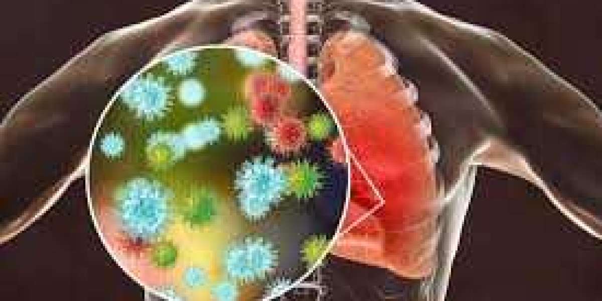 Diagnosing and Treating Respiratory Tract Infections