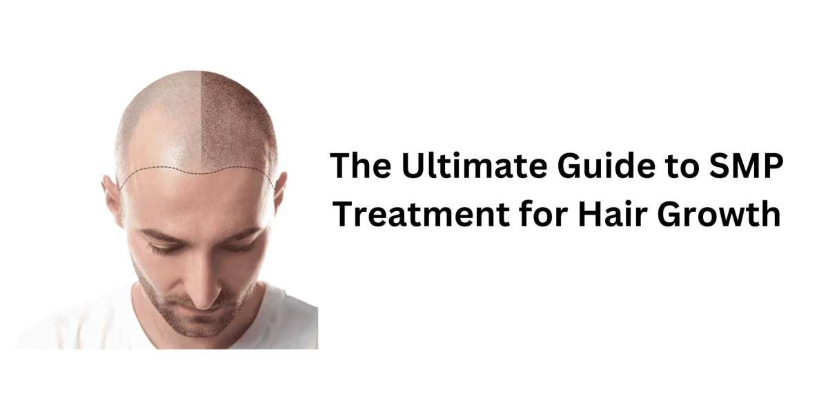 The Ultimate Guide to SMP Treatment for Hair Growth