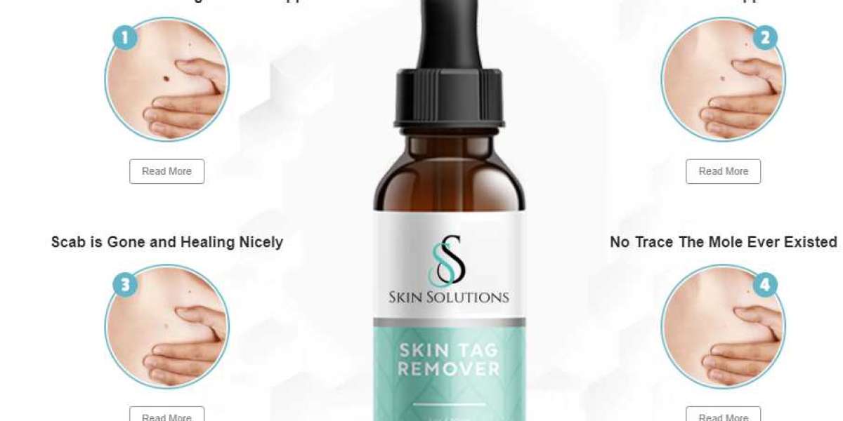 Skin Solutions Skin Tag Remover Reviews{⚠️NEW BEWARE!❌} Is Official Website Claims Fake Or Real!