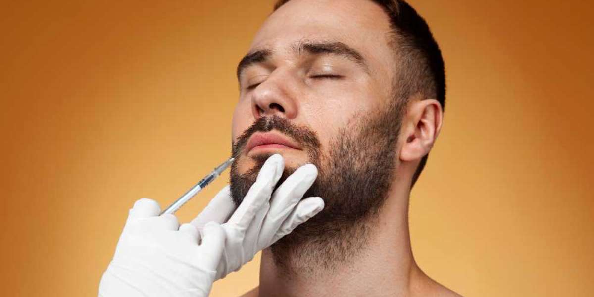 Beard Implants: The Secret to Achieving Your Ideal Beard Style