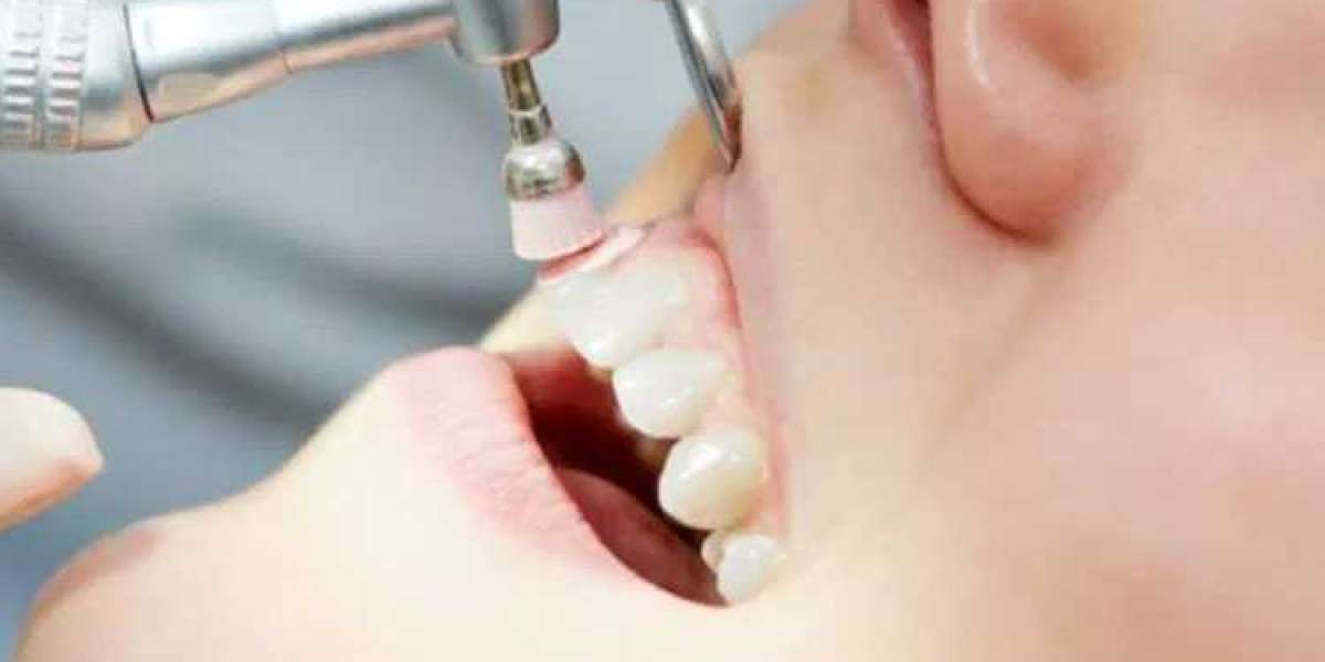 Dental implant cost in delhi