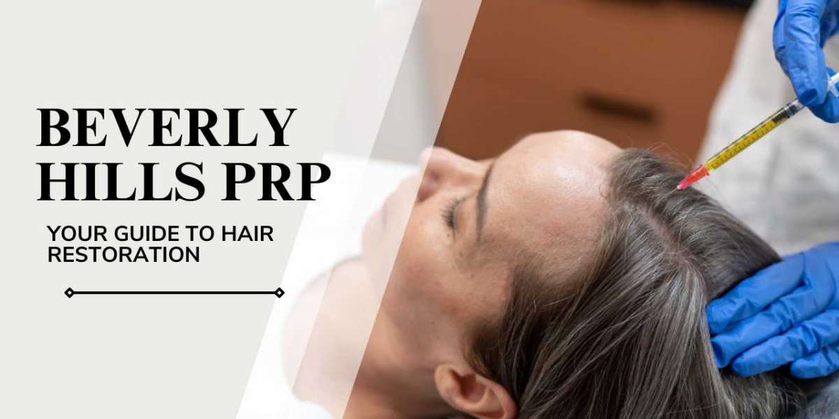 Beverly Hills PRP: Your Guide to Hair Restoration